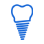 Dental Implants KK Nagar